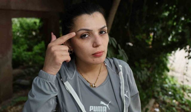 Cezaevinden firar etti, yüzünü bıçakladığı kadına ’Affına sığınıyorum’ mesajı attı