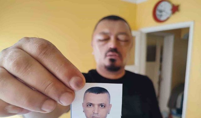 Saçlarını siyahlatmak için aldığı şampuan arı sokmasından beter hale getirdi
