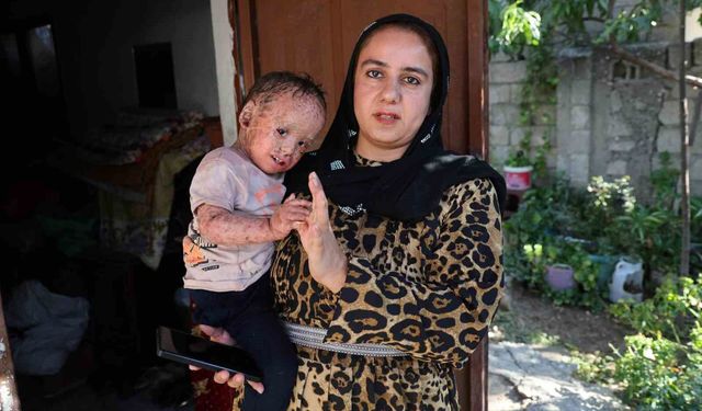 Balık pulu ve kelebek hastası Yusuf’un yardım paralarını dolandırıcılar topladı